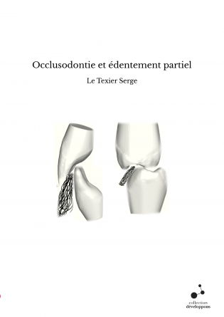 Occlusodontie et édentement partiel