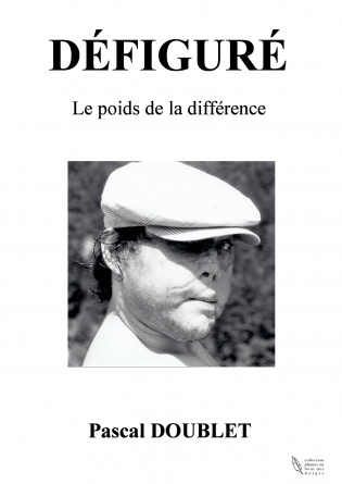 Défiguré - Le poids de la différence