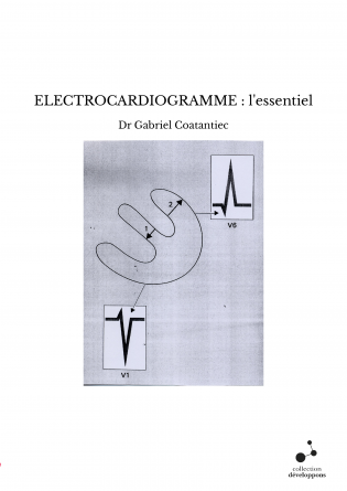 ELECTROCARDIOGRAMME : l'essentiel