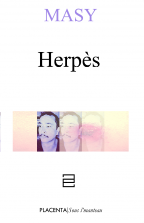 Herpès