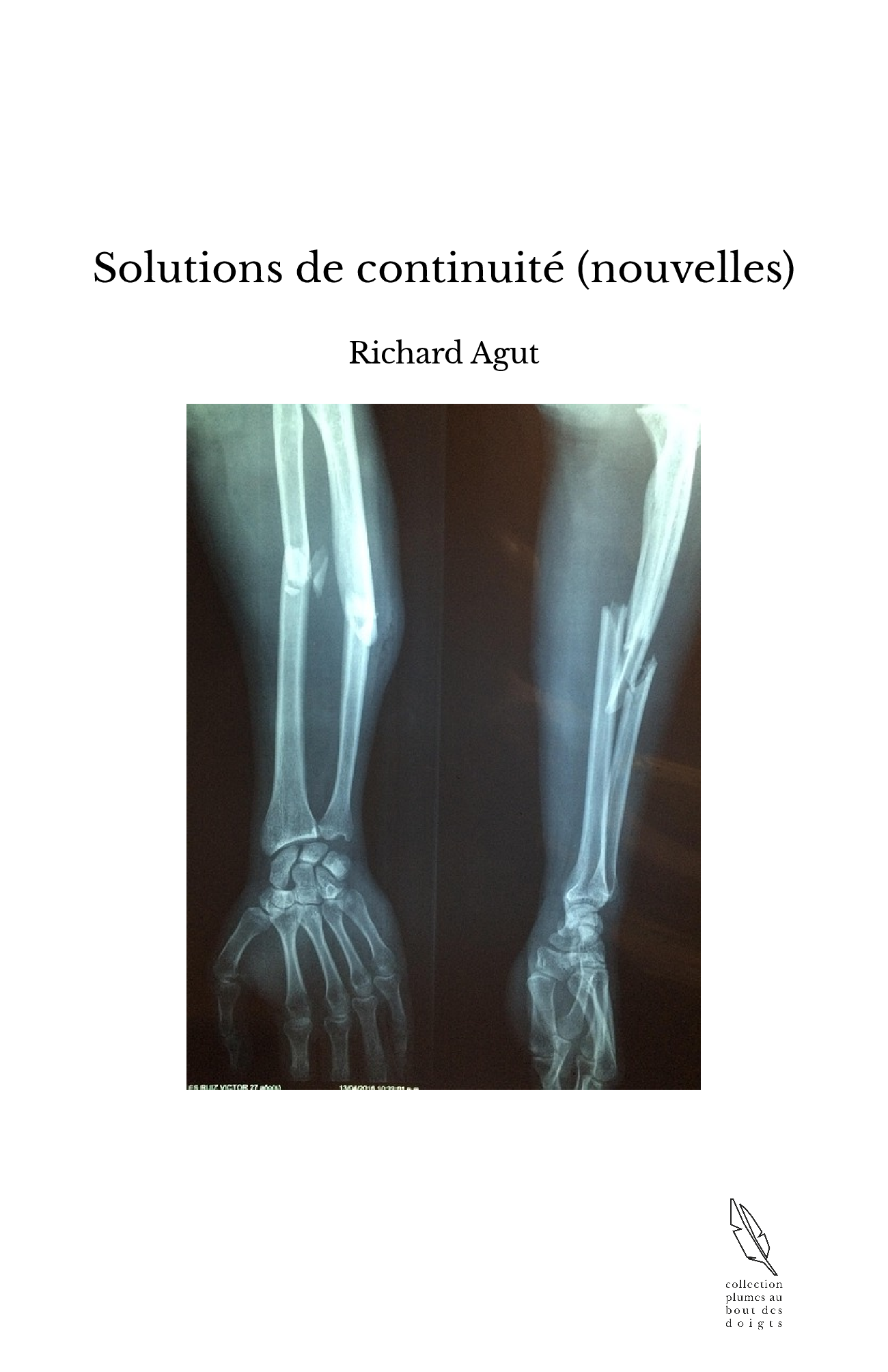 Solutions de continuité (nouvelles)