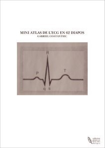 MINI ATLAS DE L'ECG EN 62 DIAPOS